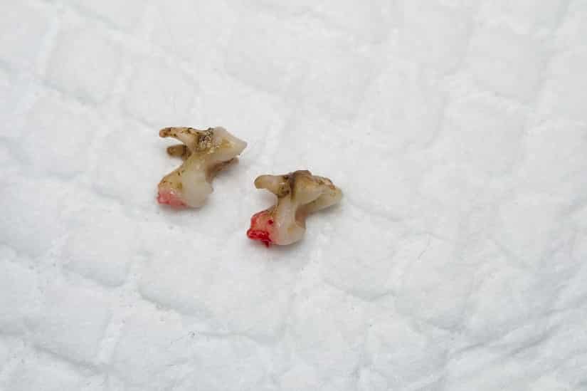 Hunde-Zahnstein kann zum Verlust von Zähnen führen